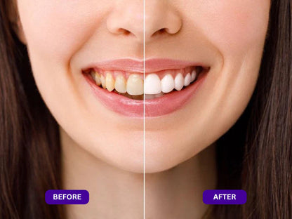 Slimleanlabs Purple Mouth Wash